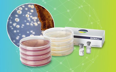 Microbiological Quality Control Yeast and Mold 