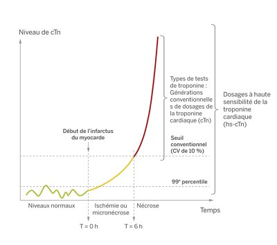Graphique de la troponine