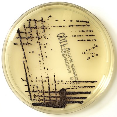 CHROMID C. difficile REF 43871