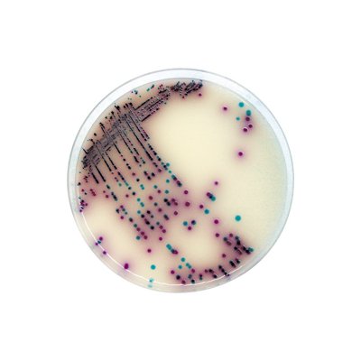 ASP is a selective medium for the isolation of Salmonella from foodstuffs and environment samples.​