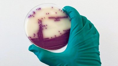 ASAP is a chromogenic medium for the isolation of Salmonella.