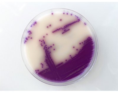 ASAP is a chromogenic medium for the isolation of Salmonella.