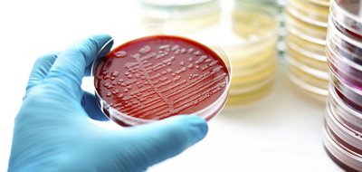 BACT/ALERT® Blood Culture Testing, Microbial Detection