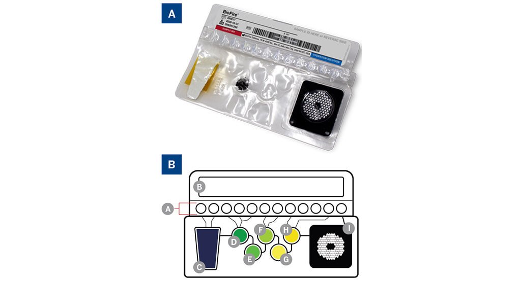 BIOFIRE MYCOPLASMA