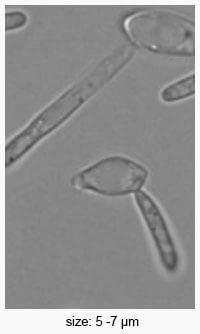 Brettanomyces