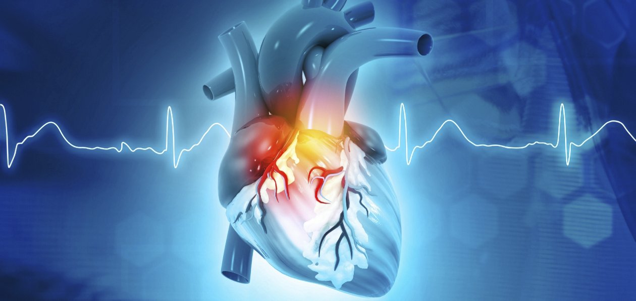 Cardiovascular Diseases