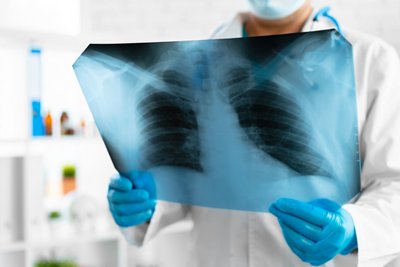 Doctor examining lungs x-ray scan in his office in hospital close up