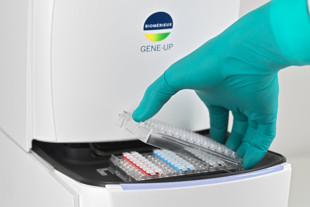 Home Pioneering Diagnostics Home Pioneering Diagnostics