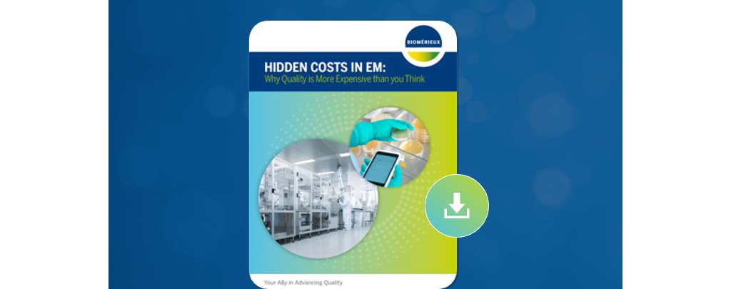 Hidden Costs in EM