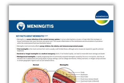 Meningitis monograph