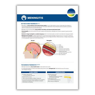 Meningitis is a severe infection of the central nervous system. It occurs when bacteria, viruses, or fungi infect the meninges, or tissue membranes that cover the brain and spinal cord. This causes inflammation of the membranes and accumulation of purulence within the cerebrospinal fluid.