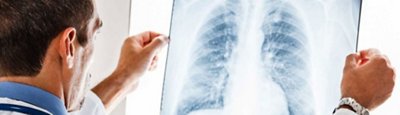 Person examines x-ray of chest