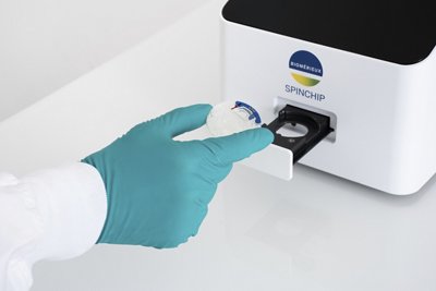 bioMérieux Launches SPINCHIP® hs-cTnl