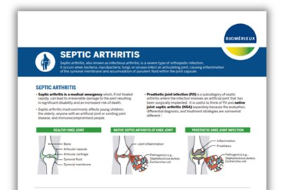 Septic arthritis, also known as infectious arthritis, is a severe type of orthopedic infection.  It occurs when bacteria, mycobacteria, fungi, or viruses infect an articulating joint, causing inflammation of the synovial membrane and accumulation of purulent fluid within the joint capsule.