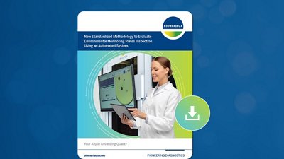 Detection of Small Events in Environmental Monitoring Culture Media