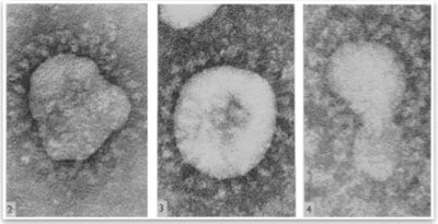 Almeida J, Tyrrell D.A.J. The Morphology of Three Previously Uncharacterized Human Respiratory Viruses that Grow in Organ Culture. Journal of General Virology. 1967;1(2):175-178.
