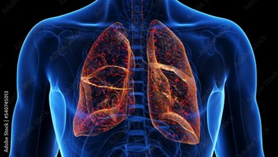 Procalcitonin May Help Reduce Unnecessary Antibiotic use in Patients with Non-Pneumonia Lower Respiratory Tract Infections