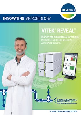 VITEK REVEAL Brochure Thumbnail