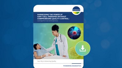 Detection of Small Events in Environmental Monitoring Culture Media