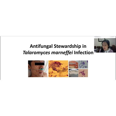 ISID Webinar: Antifungal Stewardship - Talaromyces Marneffei and Cryptococcus Neoformans