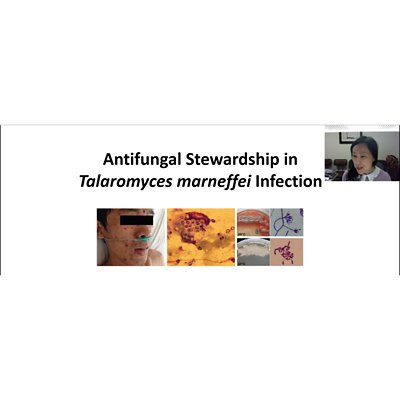 bioMérieux - ISID Webinar Antifungal Stewardship - Talaromyces Marneffei and Cryptococcus Neoformans