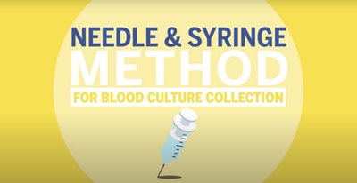 blood culture collection - two methodologies