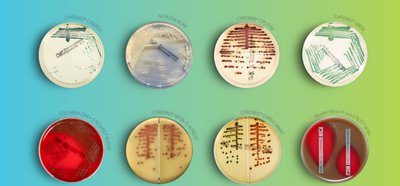 Access video tutorials related to ARGENE® molecular diagnostic solutions.