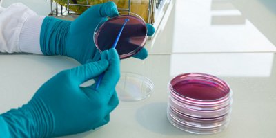 GENE-UP® Pathogenic E. coli