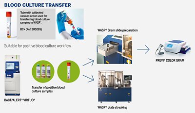 Positive blood culture workflow