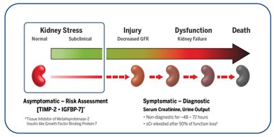 Illustration of Kidney stress progressing