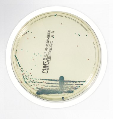 CHROMID Candida