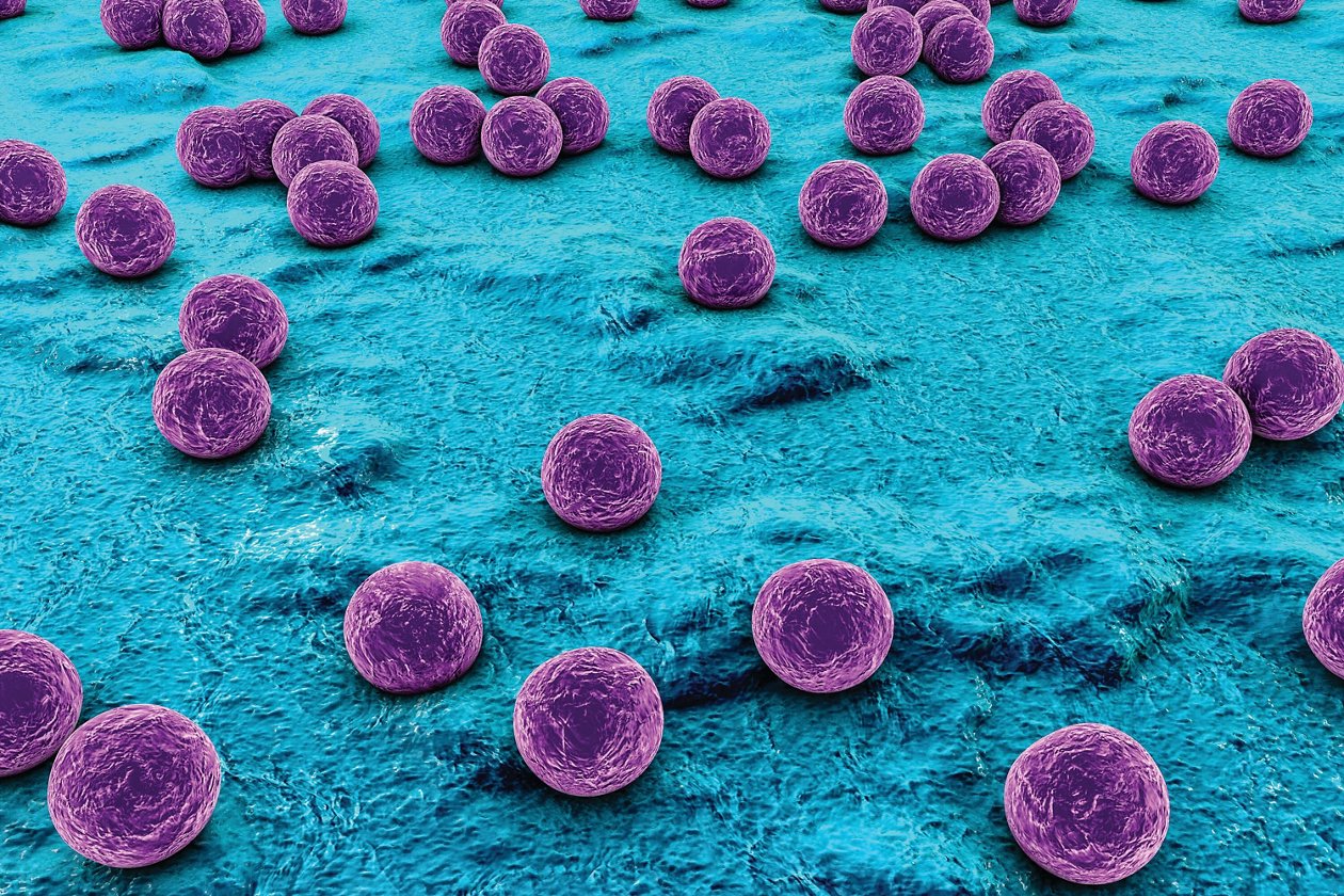 Prevention and Control of a Staphylococcus aureus Infection