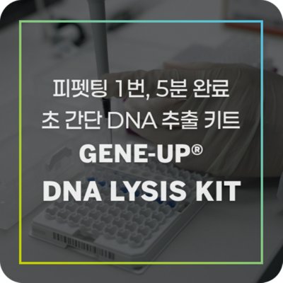blog_GENE-UP-LYSIS-KIT