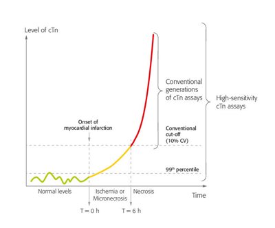 Troponin chart