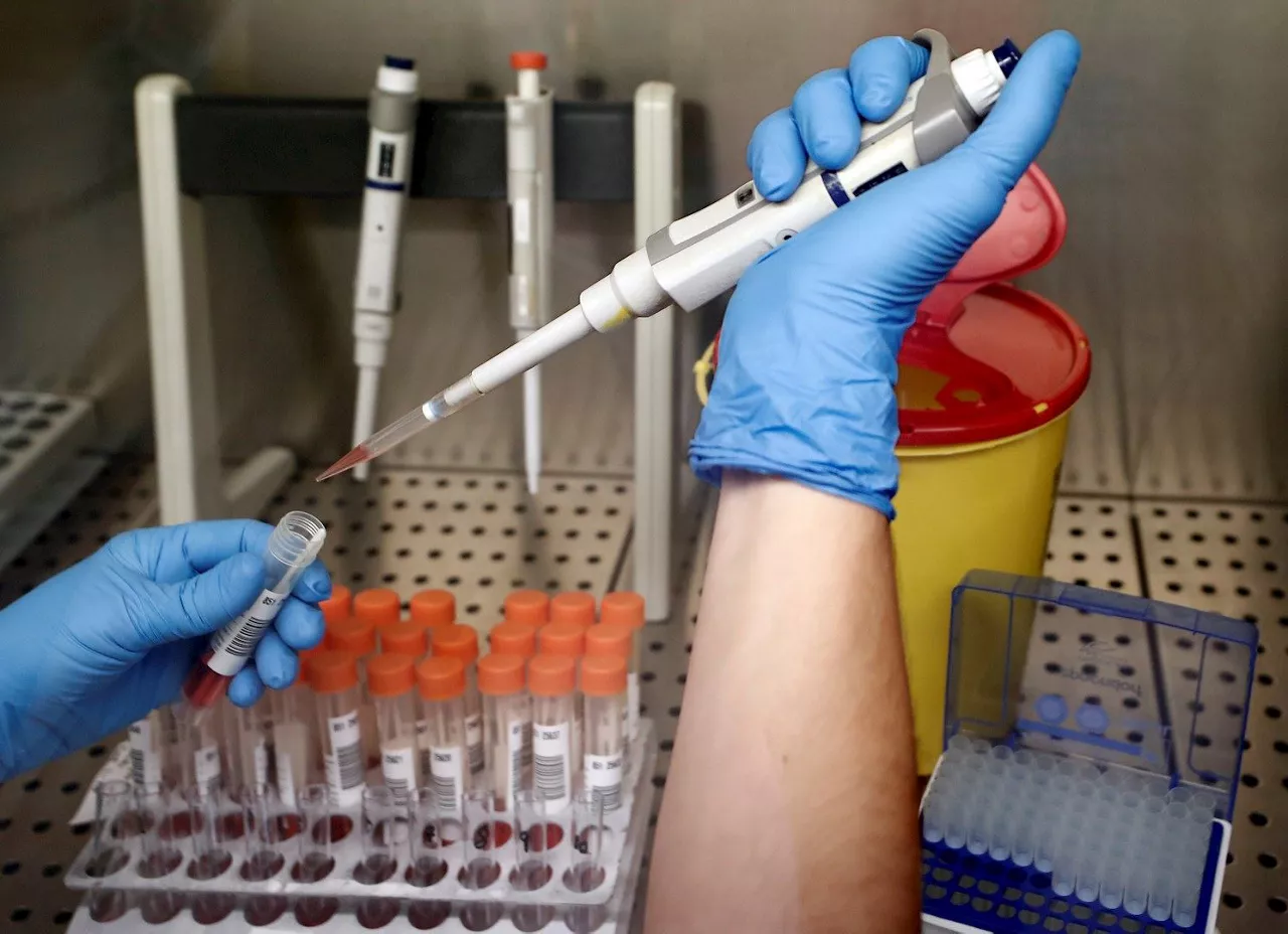 Laboratorio navarro donde se analizan las pruebas PCR