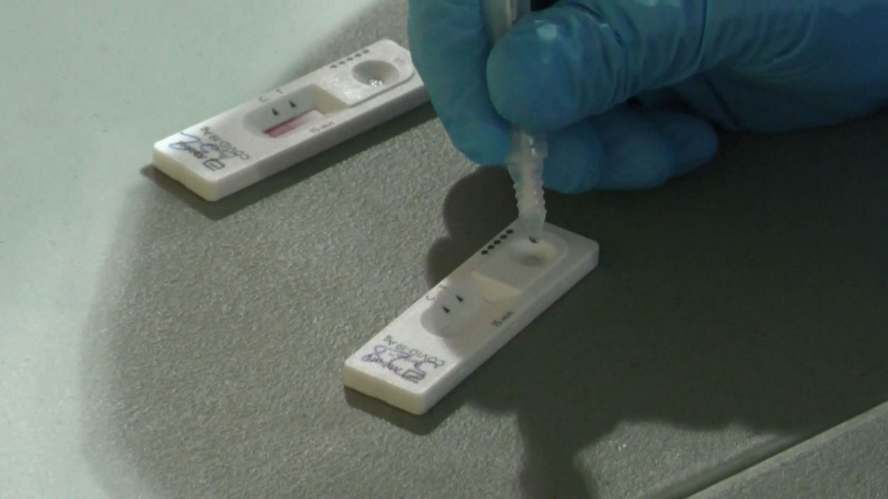 Un test de antígenos