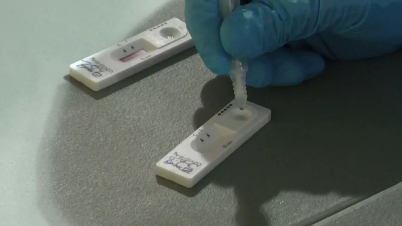 Un test de antígenos