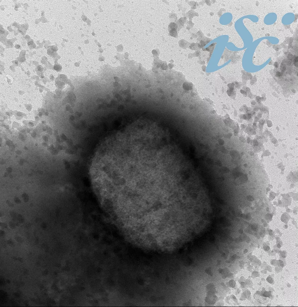 Virus de la viruela del mono por microscopía electrónica, facilitada por el Instituto de Salud Carlos III (ISCIII).