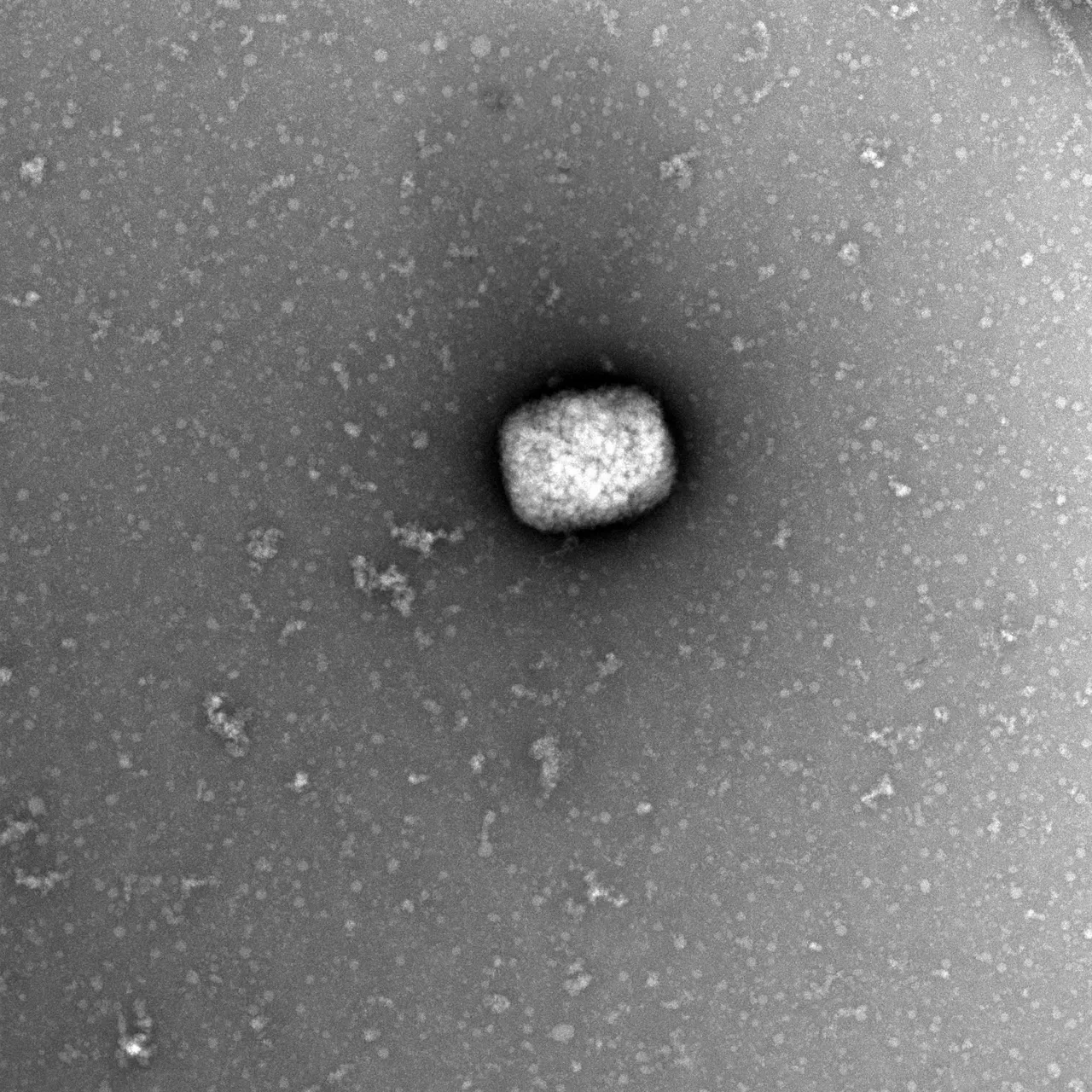 VIRUELA-MONO-PARTICULAS-VIRALES-EFE.JPG