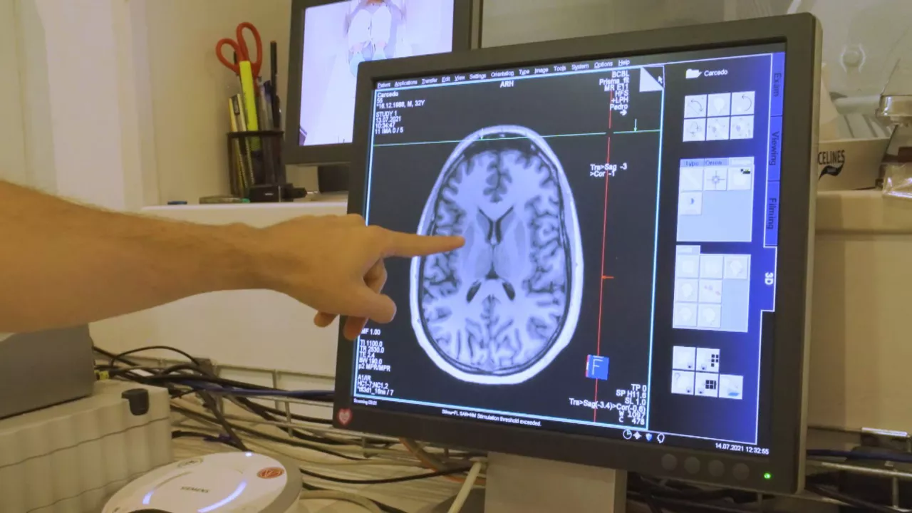Imagen de nuestro cerebro en un experimento en el BCBL. Foto: EITB Media