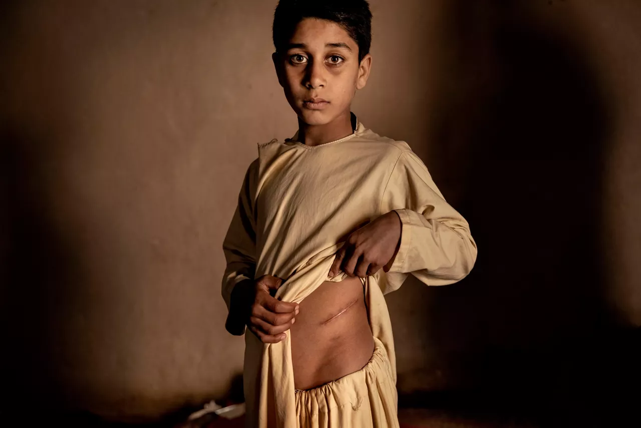 World Press Photo Story of the Year Foto: Mads Nissen 