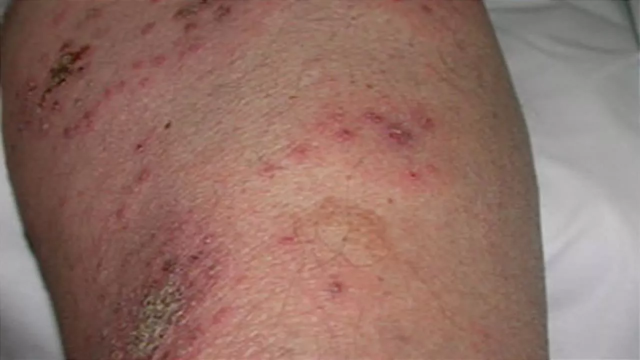 Hazteri kasu bat. Artxiboko irudia: EITB