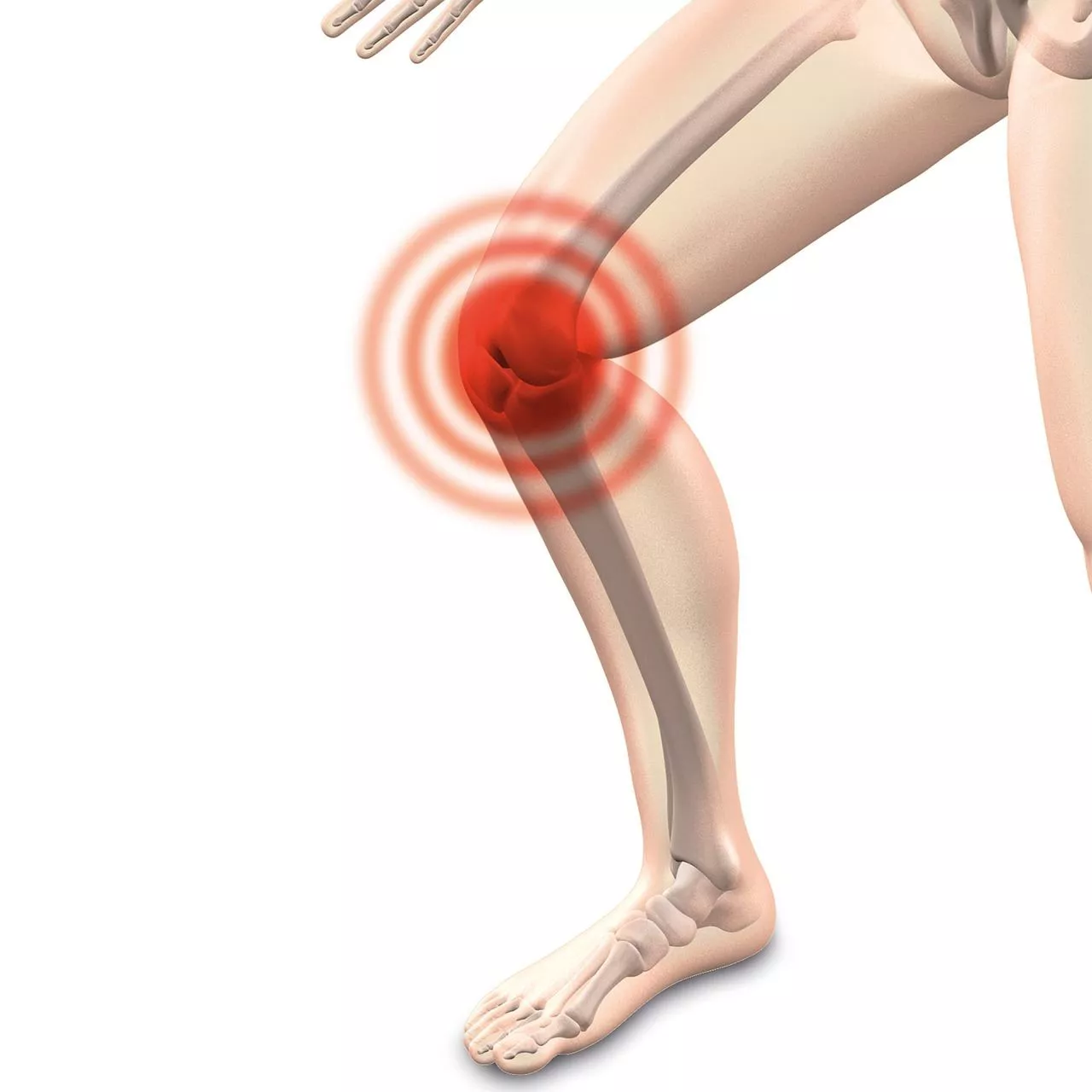 rodilla-belauna-atrosis-pixabay