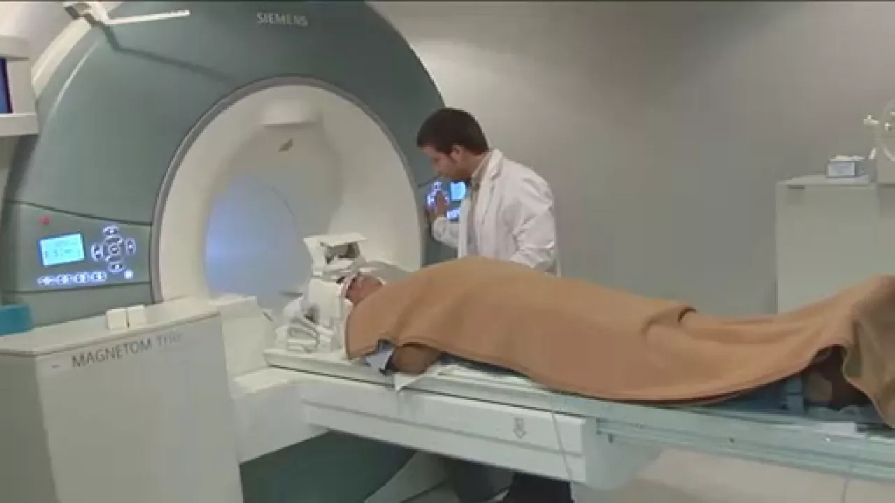 alzheimer