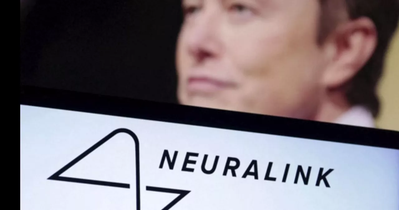 neuralink-telephaty-elonmusk-implante-eitb