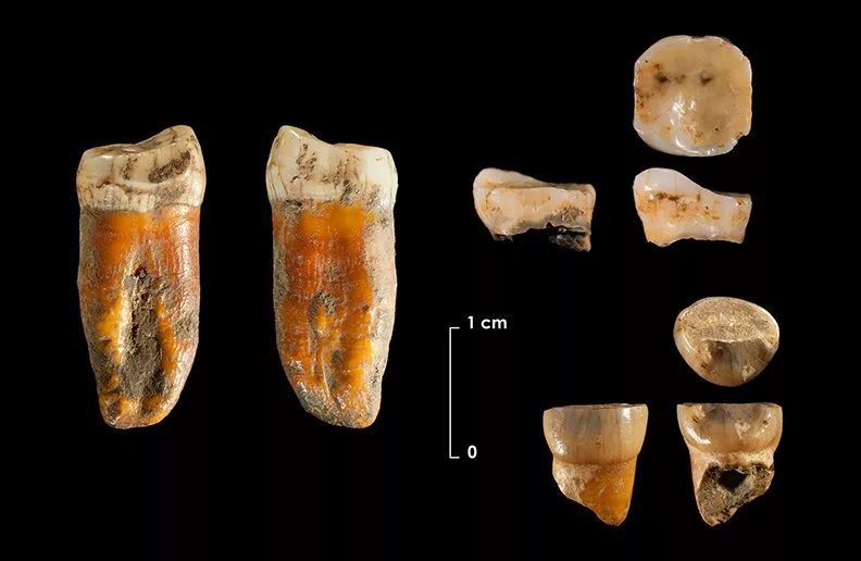 Restos dentales yacimiento de Axlor Foto UC