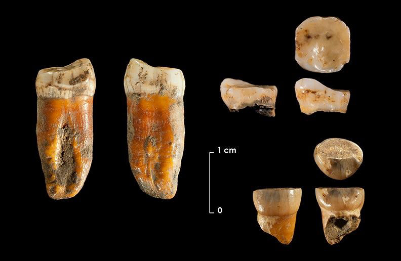 Restos dentales yacimiento de Axlor Foto UC