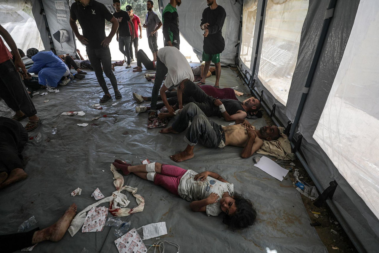 palestinos-heridos-hospital-al-awda-efe