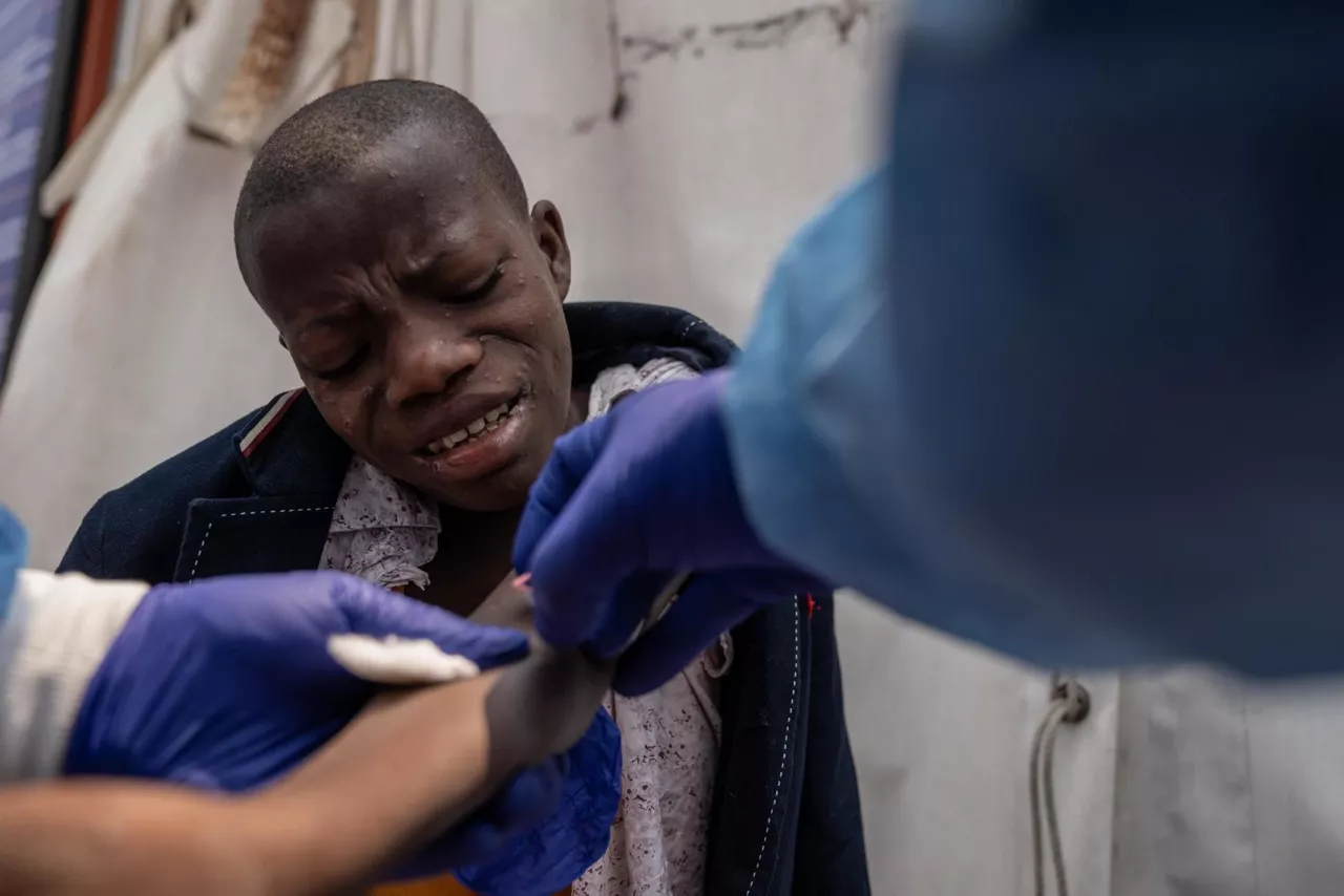 GOMA-republica-democratica-congo-mpox-paciente-efe-3