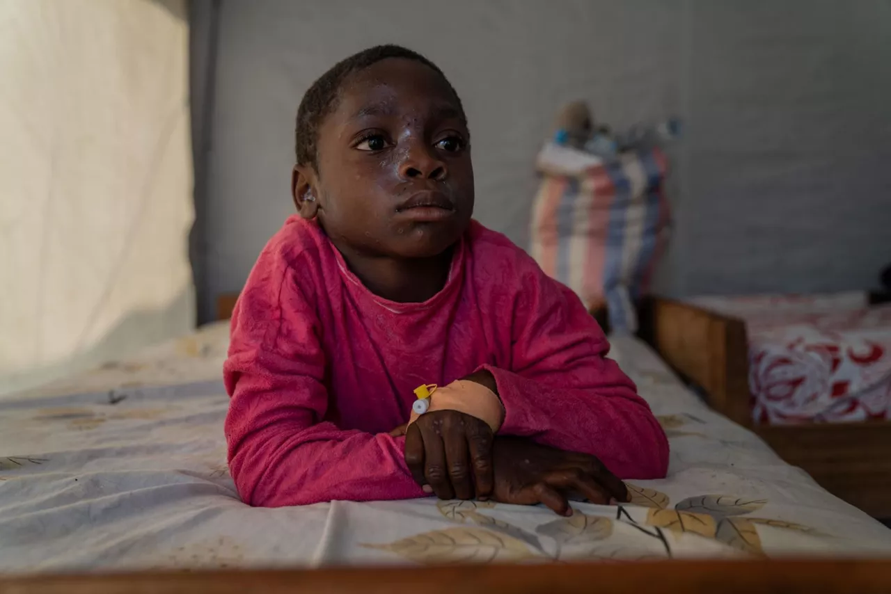 GOMA-republica-democratica-congo-mpox-paciente-efe